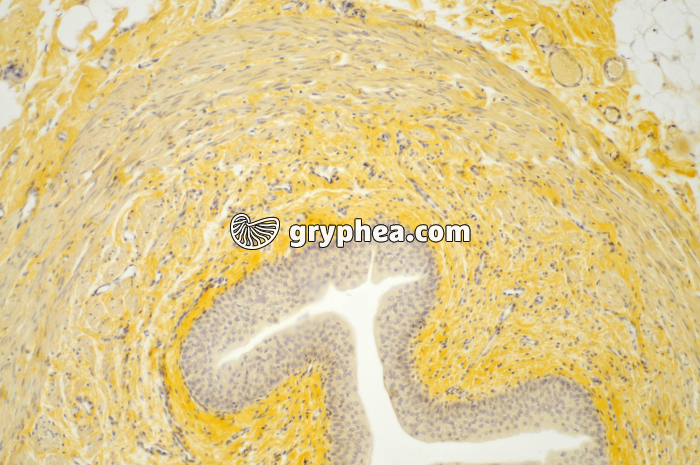 Urêtre muscle lisse x40 - gryphea.com